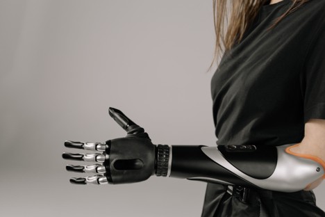 Ulysses Advised u.ventures on Its Investment in Esper Bionics